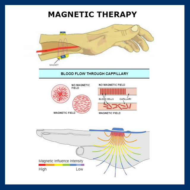 Magnetic Therapy is a holistic alternative therapy that is used to relieve stress, depression, headaches and pain, to accelerate and promote healing, and to slow disease processes such as cancer and infections. | Access Possibilities